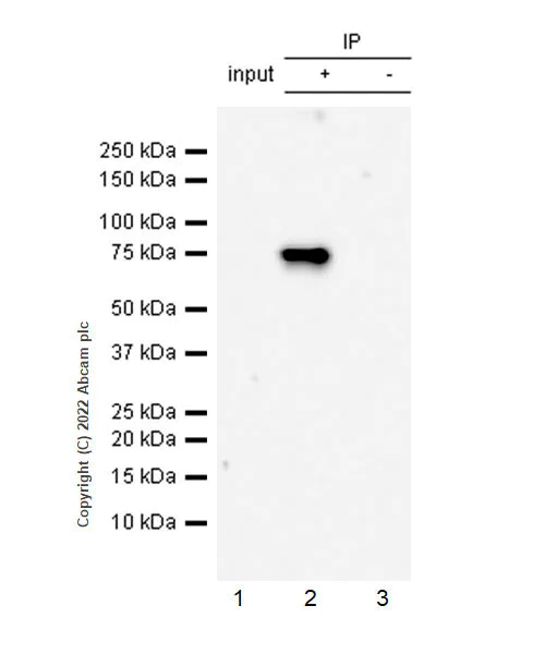 Immunoprecipitation - Anti-ALK(pY1507) antibody [EPR26946-33] - BSA and Azide free (AB305067)