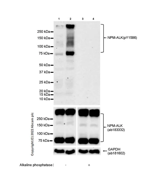 Western blot - Anti-ALK(pY1586) antibody [EPR26900-88] (AB305097)