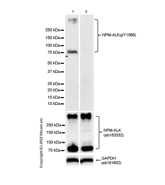 Western blot - Anti-ALK(pY1586) antibody [EPR26900-88] (AB305097)
