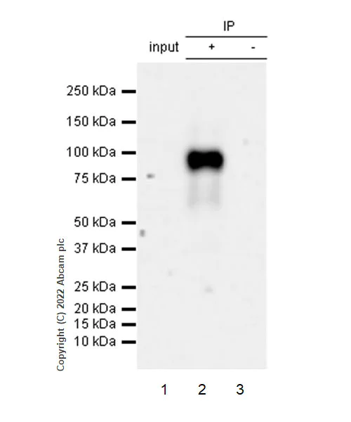 Immunoprecipitation - Anti-ALK(pY1586) antibody [EPR26900-88] - BSA and Azide free (AB305066)