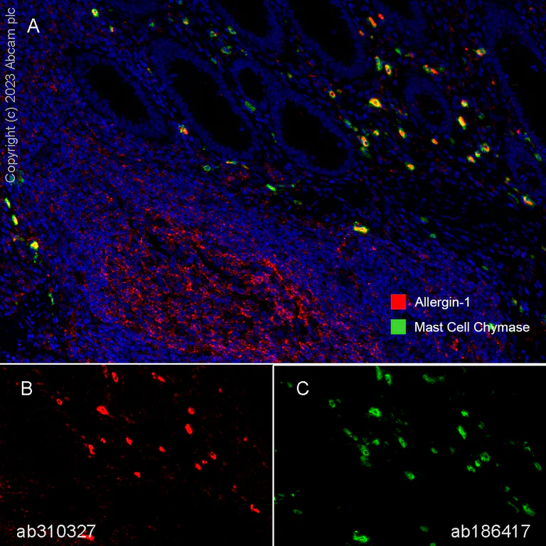 Multiplex immunohistochemistry - Anti-Allergin 1 antibody [EPR27238-51] (AB310327)