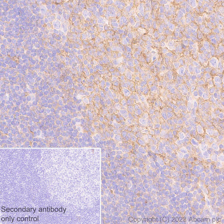 Immunohistochemistry (Formalin/PFA-fixed paraffin-embedded sections) - Anti-Allergin 1 antibody [EPR27238-51] - BSA and Azide free (AB310328)