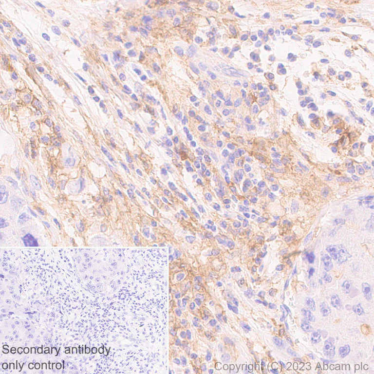 Immunohistochemistry (Formalin/PFA-fixed paraffin-embedded sections) - Anti-Allergin 1 antibody [EPR27238-51] - BSA and Azide free (AB310328)