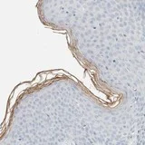 Immunohistochemistry (Formalin/PFA-fixed paraffin-embedded sections) - Anti-ALOX12B antibody (AB121785)