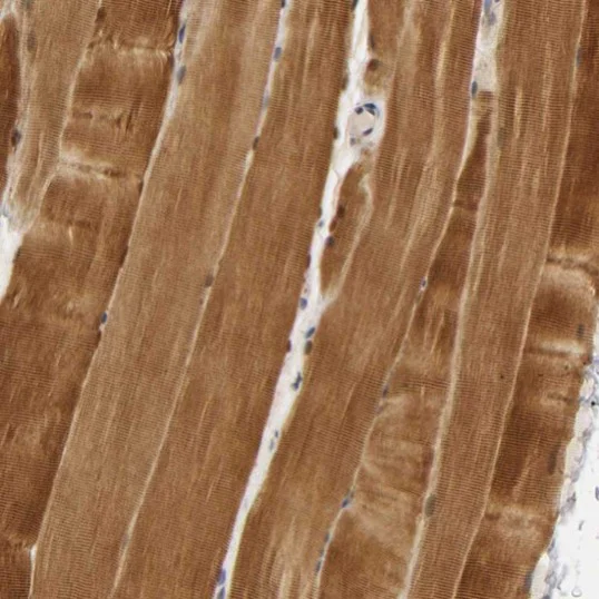 Immunohistochemistry (Formalin/PFA-fixed paraffin-embedded sections) - Anti-ALP antibody (AB224335)