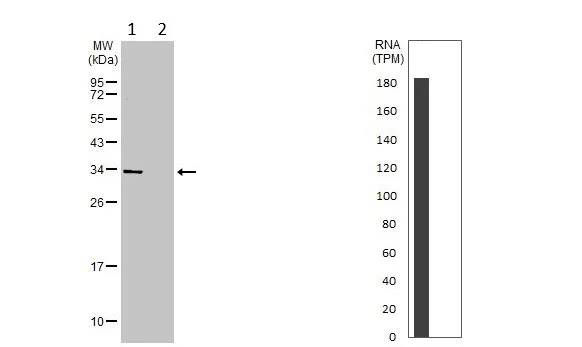 Western blot - Anti-ALP antibody (AB229126)