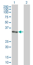 Western blot - Anti-ALP antibody (AB67228)