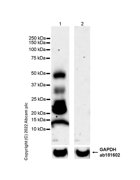 Western blot - Anti-ALP antibody [EPR27191-14] (AB307726)