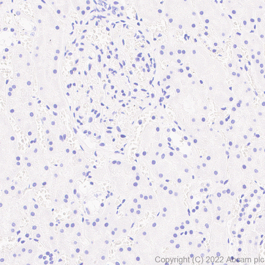 Immunohistochemistry (Formalin/PFA-fixed paraffin-embedded sections) - Anti-ALP antibody [EPR27191-14] - BSA and Azide free (AB307727), expandable thumbnail