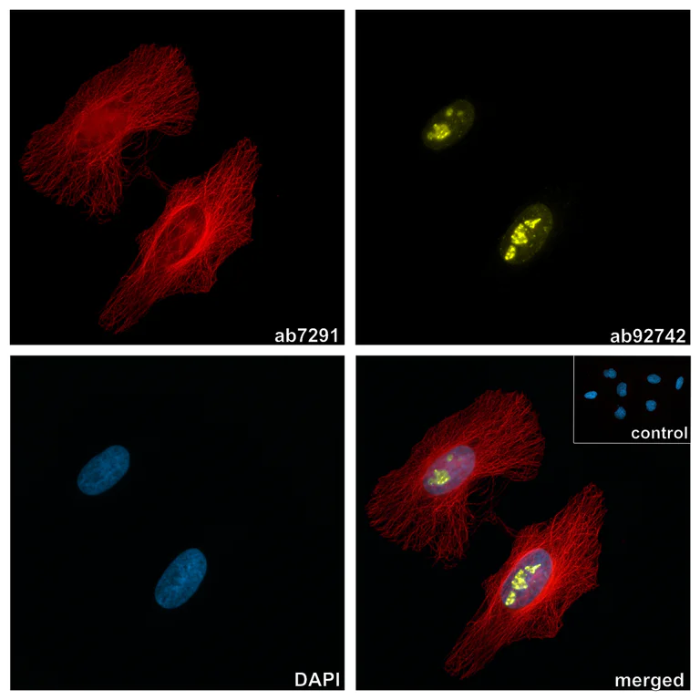 Immunocytochemistry/ Immunofluorescence - Alpaca monoclonal [10A4] Anti-Mouse IgG1 antibody (AZdye 568) - FluoTag®-X2 (AB325286)