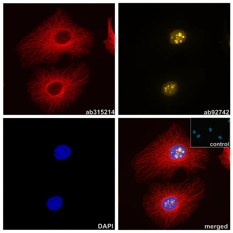 Immunocytochemistry/ Immunofluorescence - Alpaca monoclonal [14A4] Anti-Mouse IgG2a/b antibody (AZdye 568) (AB325298)