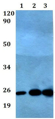 Western blot - Anti-Alpha 1 Acid Glycoprotein/AGP antibody (AB200732)