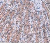Immunohistochemistry (Formalin/PFA-fixed paraffin-embedded sections) - Anti-Alpha 1 Acid Glycoprotein/AGP antibody [C1] (AB239473)