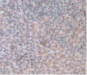 Immunohistochemistry (Formalin/PFA-fixed paraffin-embedded sections) - Anti-Alpha 1 Acid Glycoprotein/AGP antibody [C1] (AB239473)