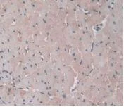Immunohistochemistry (Formalin/PFA-fixed paraffin-embedded sections) - Anti-Alpha 1 Acid Glycoprotein/AGP antibody [C1] (AB239473)