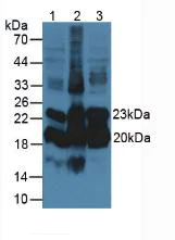 Western blot - Anti-Alpha 1 Acid Glycoprotein/AGP antibody [C1] (AB239473)