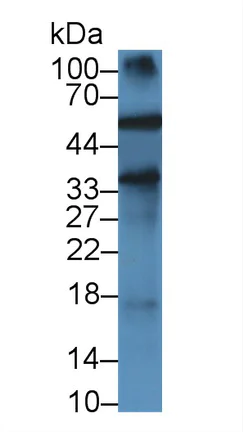 Western blot - Anti-Alpha 1 Acid Glycoprotein/AGP antibody [C1] (AB239473)