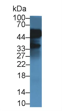 Western blot - Anti-Alpha 1 Acid Glycoprotein/AGP antibody [C1] (AB239473)