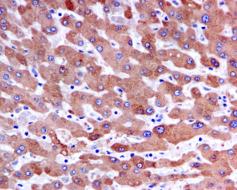 Immunohistochemistry (Formalin/PFA-fixed paraffin-embedded sections) - Anti-Alpha 1 Acid Glycoprotein/AGP antibody [EPR5605] (AB134042), expandable thumbnail