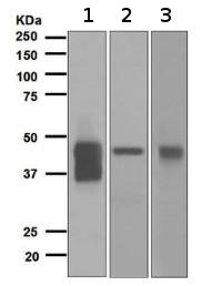Western blot - Anti-Alpha 1 Acid Glycoprotein/AGP antibody [EPR5605] (AB134042), expandable thumbnail