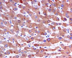 Immunohistochemistry (Formalin/PFA-fixed paraffin-embedded sections) - Anti-Alpha 1 Acid Glycoprotein/AGP antibody [EPR5605] - BSA and Azide free (AB248656)