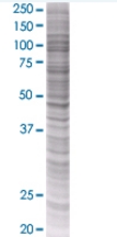 Alpha 1 Acid Glycoprotein overexpression 293T lysate (whole cell)