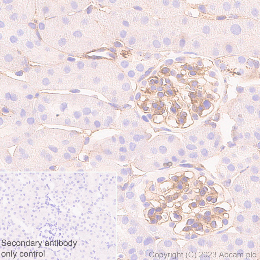 Immunohistochemistry (Formalin/PFA-fixed paraffin-embedded sections) - Anti-alpha 1 Adrenergic Receptor antibody [EPR27512-50] (AB313577), expandable thumbnail