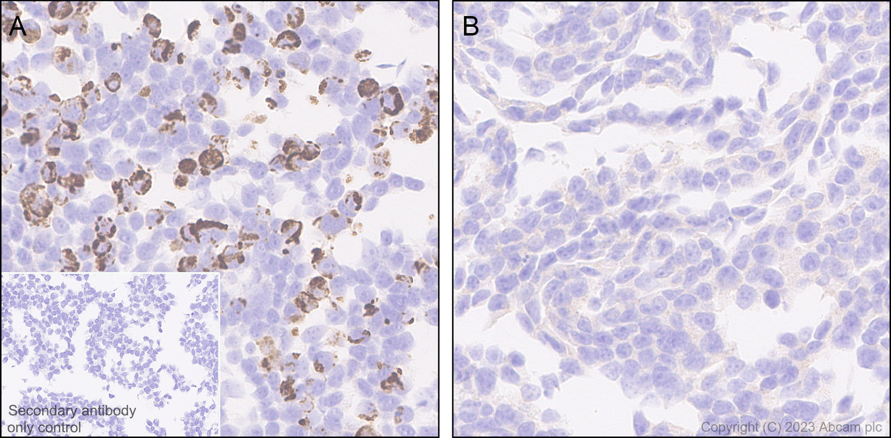 Immunohistochemistry (Formalin/PFA-fixed paraffin-embedded sections) - Anti-alpha 1 Adrenergic Receptor antibody [EPR27512-50] (AB313577), expandable thumbnail