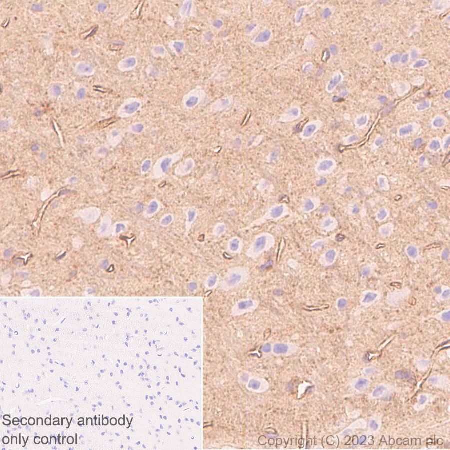 Immunohistochemistry (Formalin/PFA-fixed paraffin-embedded sections) - Anti-alpha 1 Adrenergic Receptor antibody [EPR27512-50] - BSA and Azide free (AB313578), expandable thumbnail