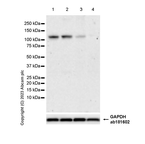 Western blot - Anti-alpha 1 Adrenergic Receptor antibody [EPR27512-50] - BSA and Azide free (AB313578), expandable thumbnail
