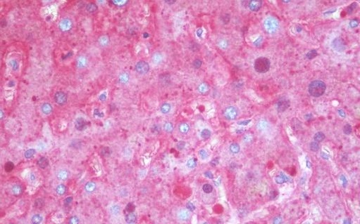 Immunohistochemistry (Formalin/PFA-fixed paraffin-embedded sections) - Anti-alpha 1 Antitrypsin antibody [11G2] (AB230695), expandable thumbnail