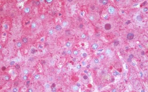 Immunohistochemistry (Formalin/PFA-fixed paraffin-embedded sections) - Anti-alpha 1 Antitrypsin antibody [11G2] (AB230695)