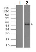 Immunoprecipitation - Anti-alpha 1 Antitrypsin antibody [11G2] (AB230695), expandable thumbnail