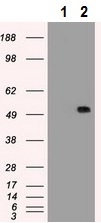 Western blot - Anti-alpha 1 Antitrypsin antibody [11G2] (AB230695), expandable thumbnail