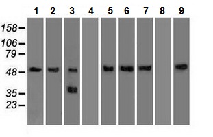 Western blot - Anti-alpha 1 Antitrypsin antibody [11G2] (AB230695), expandable thumbnail