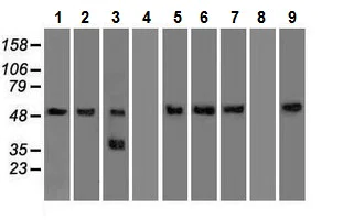 Western blot - Anti-alpha 1 Antitrypsin antibody [11G2] (AB230695)