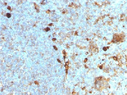 Immunohistochemistry (Formalin/PFA-fixed paraffin-embedded sections) - Anti-alpha 1 Antitrypsin antibody [AAT/1378] (AB218478)