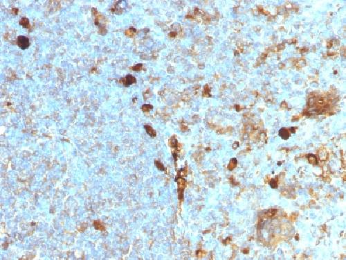 Immunohistochemistry (Formalin/PFA-fixed paraffin-embedded sections) - Anti-alpha 1 Antitrypsin antibody [AAT/1378] - BSA and Azide free (AB218933)