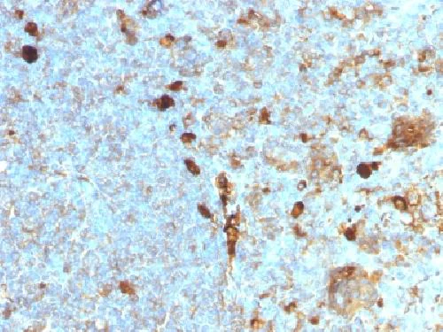 Immunohistochemistry (Formalin/PFA-fixed paraffin-embedded sections) - Anti-alpha 1 Antitrypsin antibody [AAT/1378] - BSA and Azide free (AB218933)