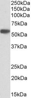 Western blot - Anti-alpha 1 Antitrypsin antibody (AB223271)