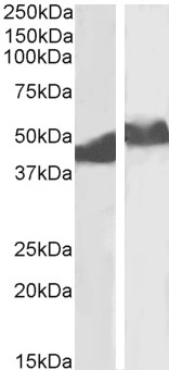 Western blot - Anti-alpha 1 Antitrypsin antibody (AB223271)