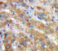 Immunohistochemistry (Formalin/PFA-fixed paraffin-embedded sections) - Anti-alpha 1 Antitrypsin antibody (AB231093)