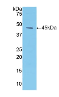 Western blot - Anti-alpha 1 Antitrypsin antibody (AB231093)