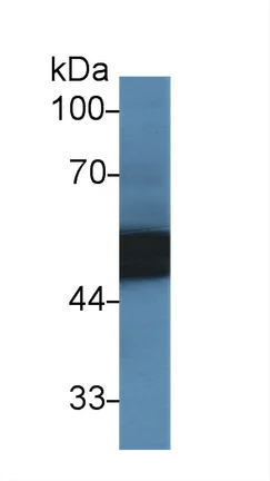 Western blot - Anti-alpha 1 Antitrypsin antibody (AB231093)