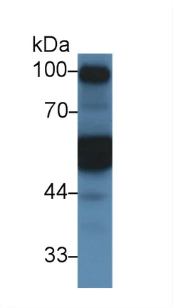 Western blot - Anti-alpha 1 Antitrypsin antibody (AB231093)