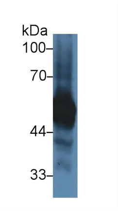 Western blot - Anti-alpha 1 Antitrypsin antibody (AB231093)