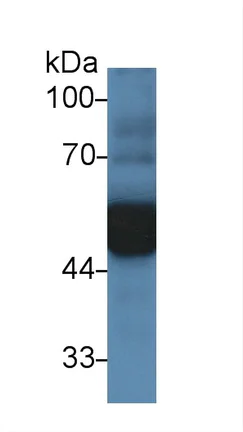Western blot - Anti-alpha 1 Antitrypsin antibody (AB231093)