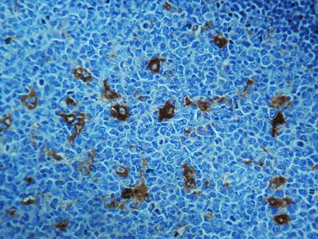 Immunohistochemistry (Formalin/PFA-fixed paraffin-embedded sections) - Anti-alpha 1 Antitrypsin antibody (AB9373)
