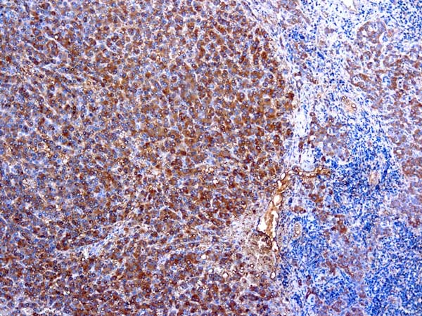 Immunohistochemistry (Formalin/PFA-fixed paraffin-embedded sections) - Anti-alpha 1 Antitrypsin antibody (AB9373)