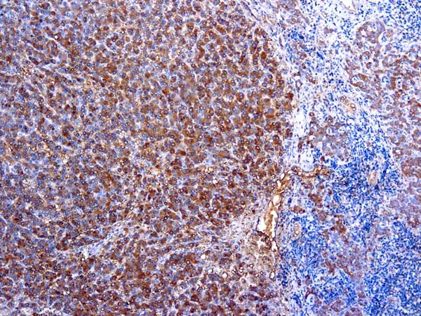 Immunohistochemistry (Formalin/PFA-fixed paraffin-embedded sections) - Anti-alpha 1 Antitrypsin antibody (AB9373)